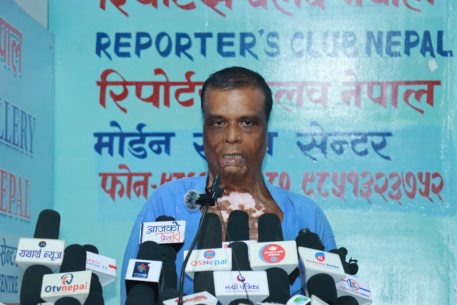 आलमले सफाइ पाए, बम लागेका गौरीशंकर पीडा सुनाउन काठमाडौं आए 