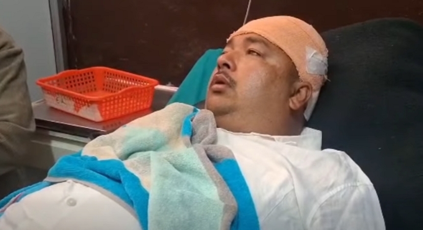 वडाध्यक्षमाथि एमाले कार्यकर्ताद्वारा कुटपिट